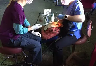 Cleaning teeth 
