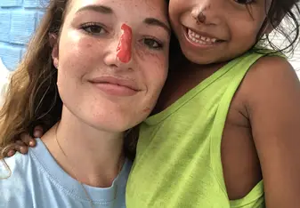Our noses match now.