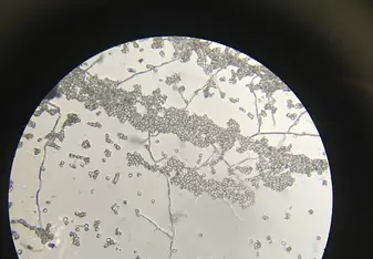 Fungal Microscopy