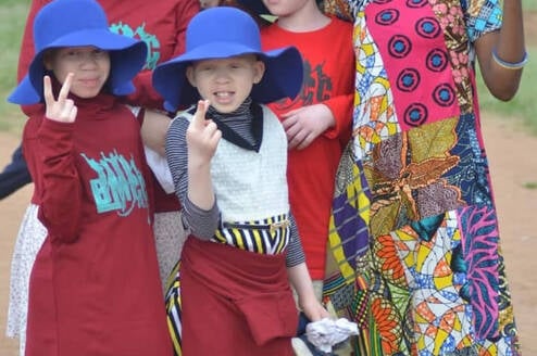 Volunteer to help kids with albinism