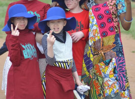 Volunteer to help kids with albinism