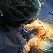 Closing a neurosurgery