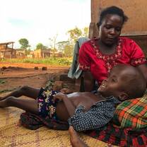 Patrick with Hydrocephalecus 