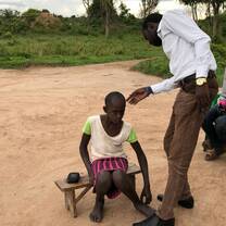 One of the malnutrution girl child in Luweero district