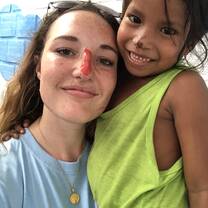 Our noses match now.