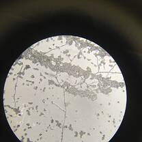Fungal Microscopy