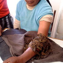 Plant-based medicine Plant-based medicine